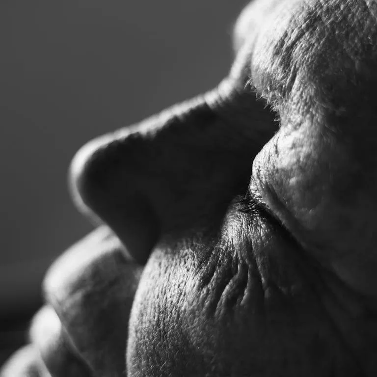 Close up of womans face showing premature wrinkles from smoking and skin ageing Melbourne hypnotherapy